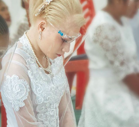 Inilah Potret Herolena Baroperay , Barbie Papua yang Viral